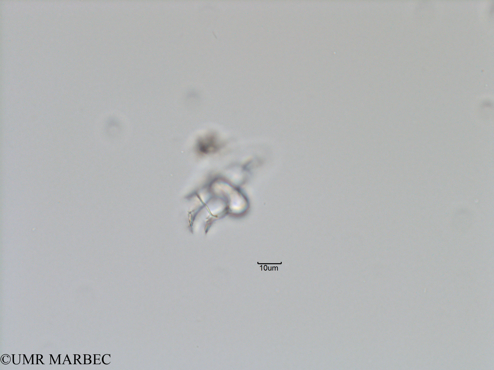 phyto/Bizerte/bizerte_bay/RISCO November 2015/Histioneis sp1 (Baie_T5-C2-Histioneis-2).tif(copy).jpg